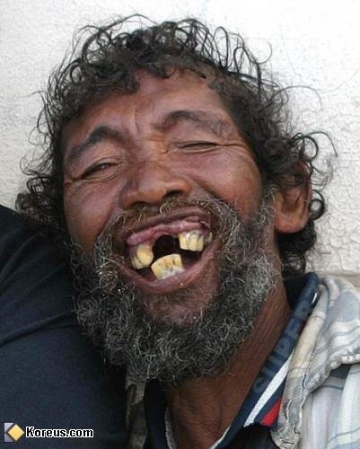 ooooooooo bien f� la position des dents